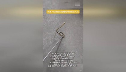 杭州大伯野外被蛇咬，用嘴吸毒液后紧急入院的惊险事件