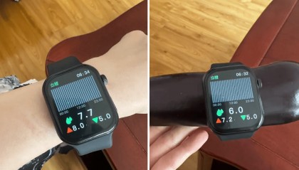 绑在茄子上也能显示血糖值!智能手表“无创测血糖”靠谱吗?